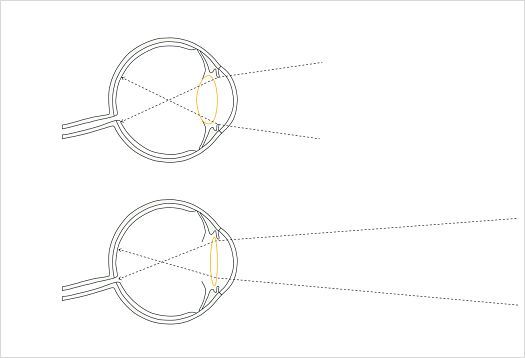 Eye accommodation diagram showing how the lens adjusts to focus on objects at varying distances.