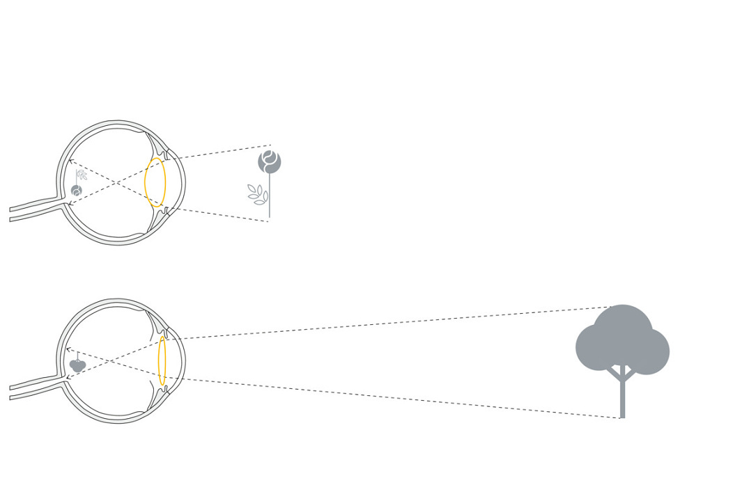 Eye accommodation diagram showing how the lens focuses for near and far vision.